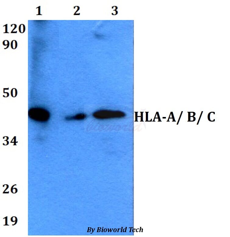 Anti-HLA-A/ B/ C Antibody (A28786) | Antibodies.com